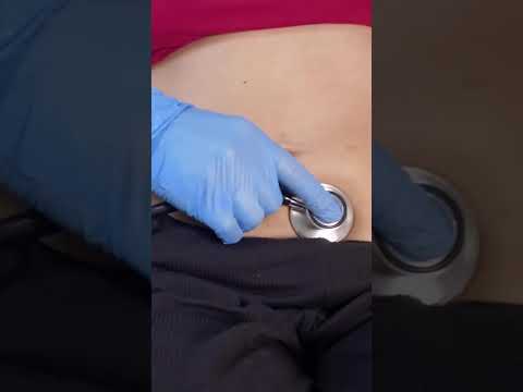 Belly Exam ASMR#asmr #roleplay #foryoupage Not a real Dr- fictional Roleplay