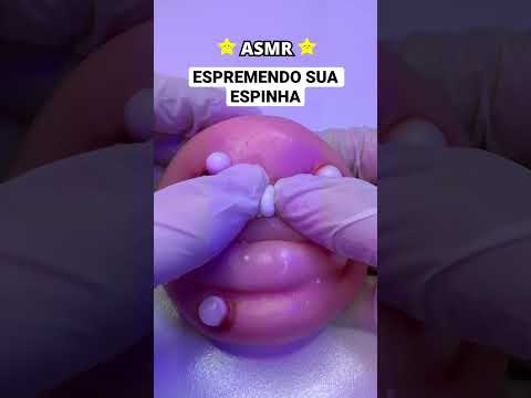 ASMR ESPREMENDO SUA ESPINHA #shorts