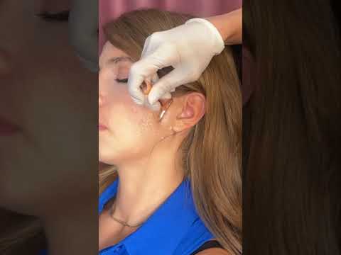 Asmr ear 👂 exam #asmr #relax #relaxing #asmrsounds #asmrvideo #tingles #medical #satisfying #sleep