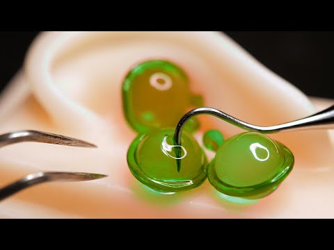 [ASMR] Deep massage of ears with oil balls [No Talking, Role play]