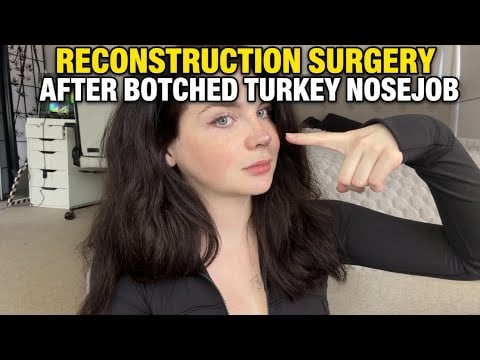 Botched in Turkey Nose Job: Reconstruction Surgery Done