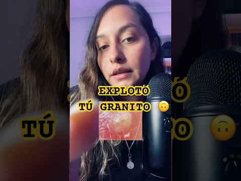 Explotó tu granito 😳 #asmr #asmrcommunity #susurros #granos #mouthsounds #mouthsoundasmr
