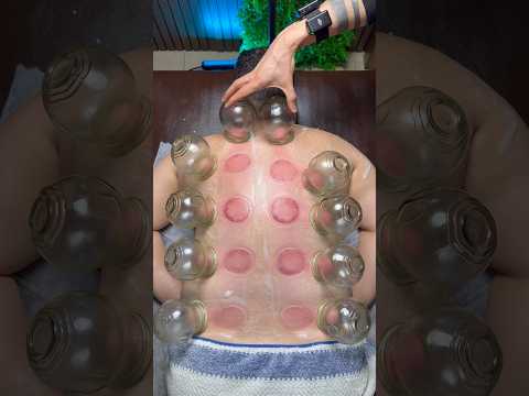ASMR CUPPING 😍❤️#shorts #explore #relax #asmr #asmrmassage #fyp #viral #cupping