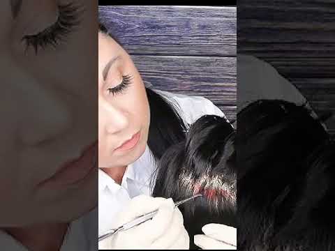ASMR Scalp Check with Bad Results #shorts