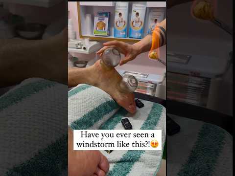 #shorts #cupping #explore #asmr ##youtube #fire