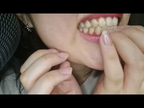 [ASMR] teeth tapping sound / 이 두들기는 소리/歯をたたく音