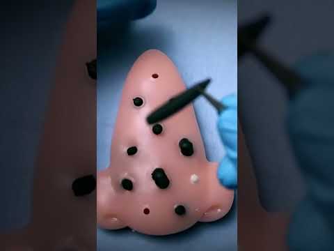 Removendo larvas do seu nariz - ASMR #shorts