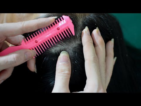 ASMR Relaxing Scalp Check / Big Flakes / Scratching / Combing For Relaxation