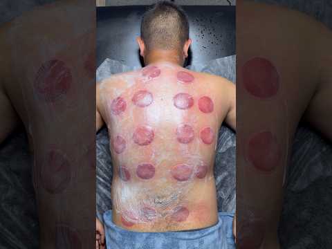 peperoni cupping😍🍕#cupping #asmr #viral #shorts