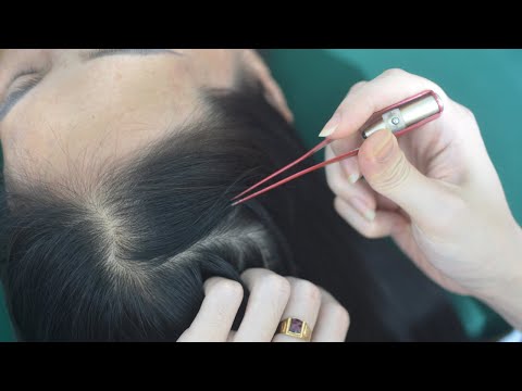 ASMR Head Scratching And Hair Combing Sounds, Head Tingling For Reduce Stress