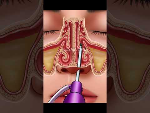 Nasal Sinus Cleaning And Nose Piercing Removal Animation, Relaxing ASMR Animation. ASMR animation.