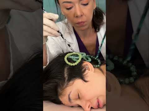 Asmr scalp tingles #asmr #asmrsounds #asmrvideo #relax #relaxing #satisfying #hair #sleep #tingles