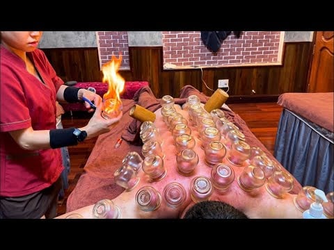 ASMR 🇻🇳 I Didn't Expect to Meet Such a Cute Therapist in Vietnam 😳 | Fire Cupping & Foot Massage