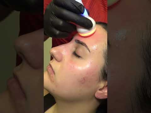 Deep Skin Cleansing, Massage And Cracks #skincare #asmr #cracks #femalemassage #cleaning #relaxasmr