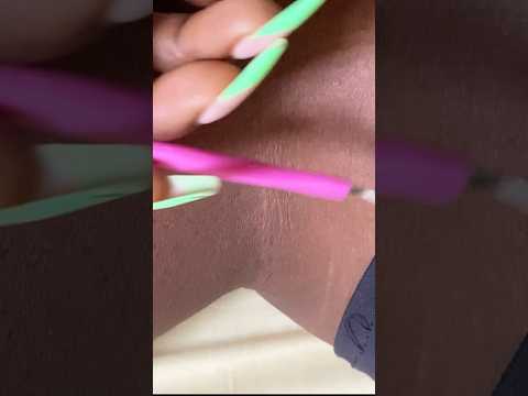 ASMR BEST LEG PICKING AND CLEANING #asmr