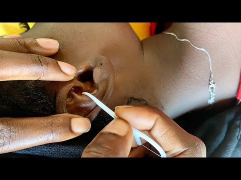 ASMR EAR PICKING AND CLEANING VERY RELAXING ASMR FOR SLEEP WITH GUM CHEWING