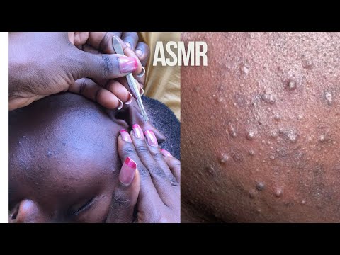 Asmr deep ear cleaning & facials #asmr #satisfying #relaxation