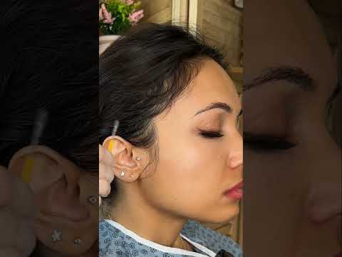 Asmr ear 👂 exam #asmr #relax #relaxing #asmrsounds #asmrvideo #tingles #medical #satisfying #sleep