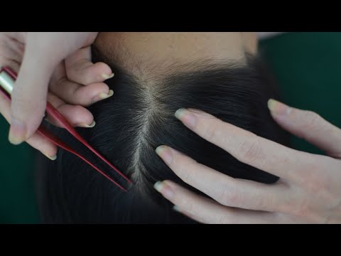 ASMR Real Person Scalp Scratching Aggressive Make You Feel Relieve Stress