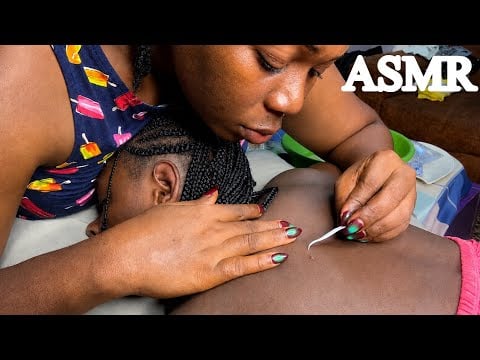 ASMR✨Relaxing Back Nitpicking That Will Put You To Good Sleep