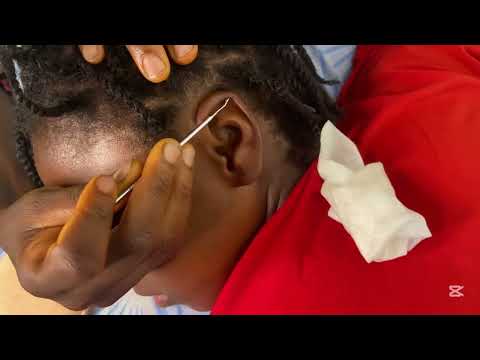 Ear Cleaning Massage Asmr,  Very Satisfying Ear Piercing Cleaning With Gum Chewing