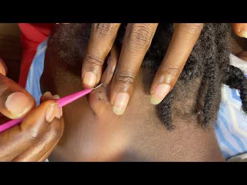 ASMR EAR CLEANING, FACE PICKING, SCALP MASSAGE, SCALP SCRATCHING NO GUM CHEWING