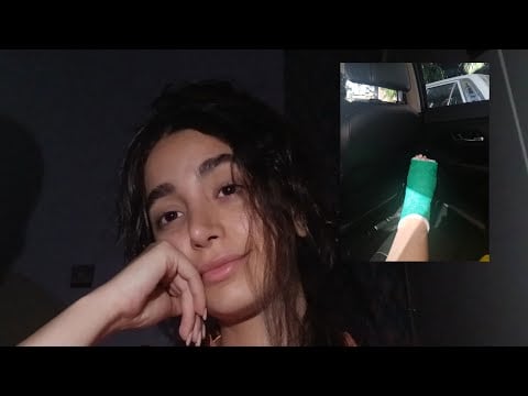 Asmr🤭 broken leg🦶🏻