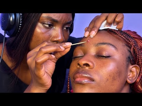 ASMR ✨DEEP EAR CLEANING PIMPLE NITPICKING, EAR EATING WHISPERING FOR INSTANT SLEEP, SPIT PAINTING 