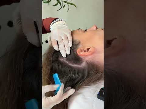 Asmr scalp tingles #asmr #asmrsounds #asmrvideo #relax #relaxing #satisfying #hair #sleep #tingles