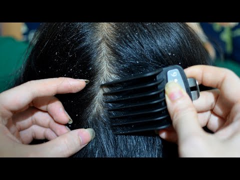 ASMR Scalp Check Relaxing For Sleep / Dandruff Removal / Dandruff Scratching / Scalp Treatment