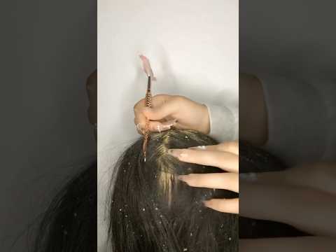 ASMR REMOVE YOUR DANDRUFF 💆🏻‍♀️ #asmr #satisfying #asmrhairplay #relax #asmrmassage #shorts