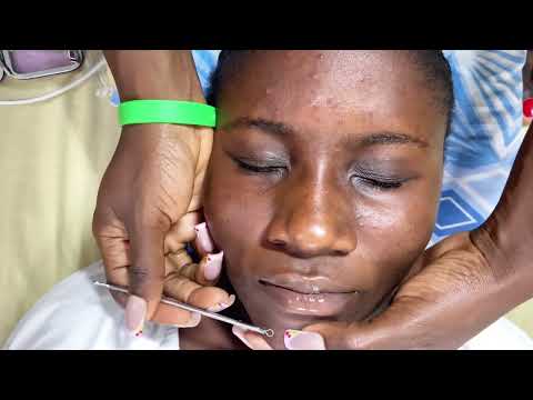 ASMR SUPER ATTENTIVE FACE MASSAGE, NIT- PICKING AND CLEANING- SO RELAXING- GUM CRACKING