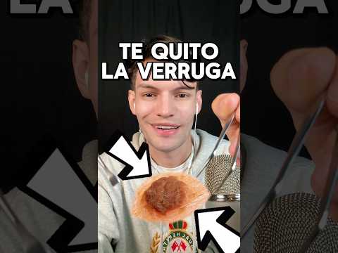 TE QUITO UNA VERRUGA #asmr #shorts #asmrvideo #comedia