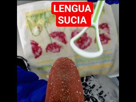 LIMPIEZA DE LENGUA LARGA🤗ASMR🤗#shorts #cortos
