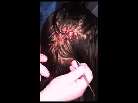 ASMR Scalp Check with Bad Results (NO TALKING) #shorts