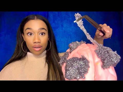 ASMR Removing Your Brain Rot (Sigma boy, Hawk Tuah, and More) 🧠🤏🏽 ASMR Plucking Sounds