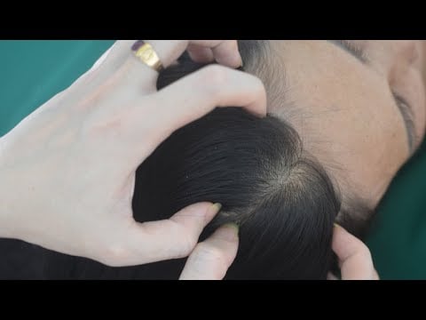 ASMR Aggressive Head Scratching Sounds With Hair Parting & Combing For Reduce Stress