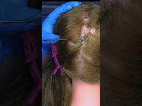 ASMR School Nurse Lice Check #shorts