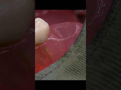 この歯医者さん、何番目でギブ？🦷ASMR - This Dentist… Which Number Is Your Limit?  #asmr #shorts