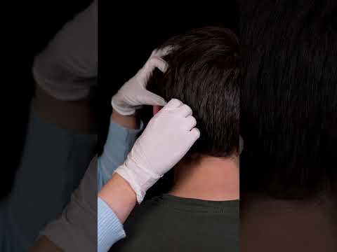 ASMR | Do you prefer a scalp inspection with sticks or gloves or neither?