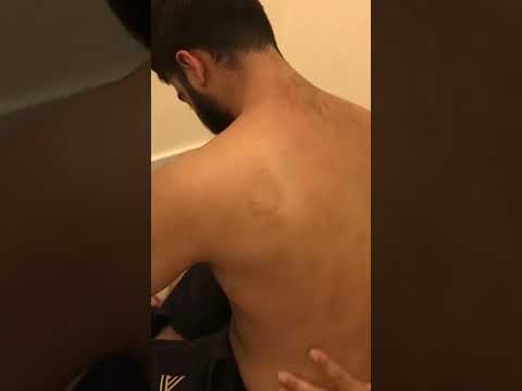 Extreme Tension Release Massage #shorts #neckpainrelief #backmassage #therapy #asmr #relax #barber