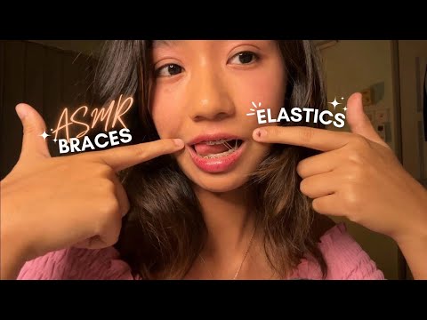 ASMR ~ MY LAST BRACES WITH ELASTICS VIDEO