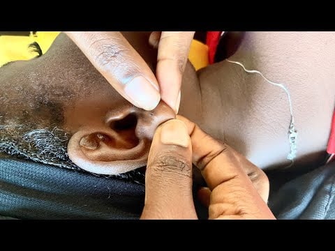 ASMR RELAXING BEST SLEEP THERAPY EAR PICKING WITH CHEWING GUM