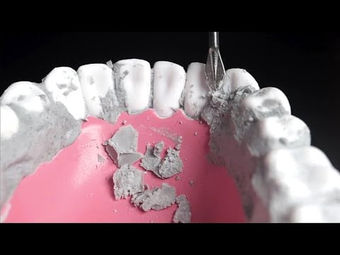 ASMR🦷 Dentist Cleans Your Teeth! 혹시 시멘트를 드셨나요? 치석 제거 해드릴게요!