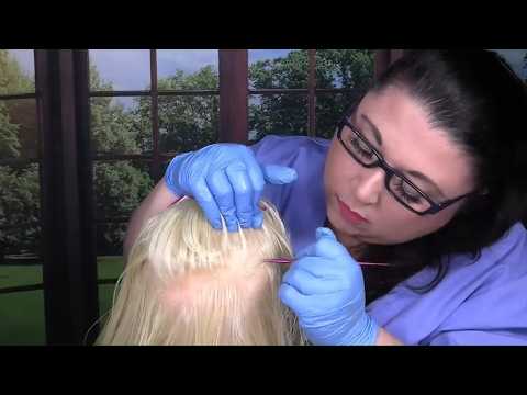 ASMR Dry Scalp Check and Treatment (Scalp Massage, Whispering) Medical Roleplay