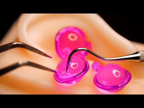 [ASMR] The Most Relaxing Ear Oil Massage (No Talking, For Sleep)