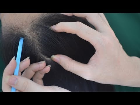 ASMR Tingly Scalp Massage, Real Person Scalp Scratch, Hair Parting For Stress Relief ( No Talking )
