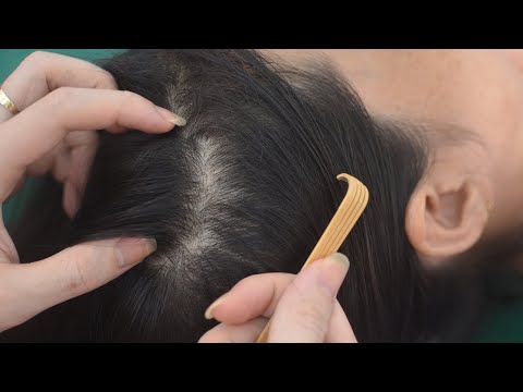 ASMR Real Person Head Scratch And Hair Combing, Hair Sounds For Reduce Headache