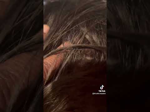 Soothing Hair Massage #asmr #hair #massage #asmrsounds #asmrvideo #asmreating #fypシ゚viral