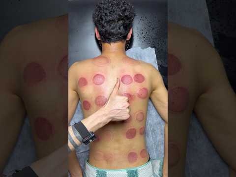 asmr wow cupping😍🔥#shorts #youtubeshorts #asmr #viral #trending